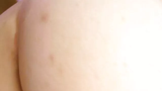 Nóng khiêu dâm, không giấy đăng ký  Một cá nhân y tá ở bệnh pim xex nhat ban viện tư tỉnh lại làm bằng tay với một vết cắn vào một nhăn chích